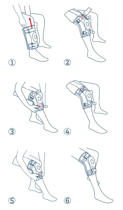 NEENCA Hinged Knee Brace with Locking Dials, ROM Knee Immobilizer for Support

