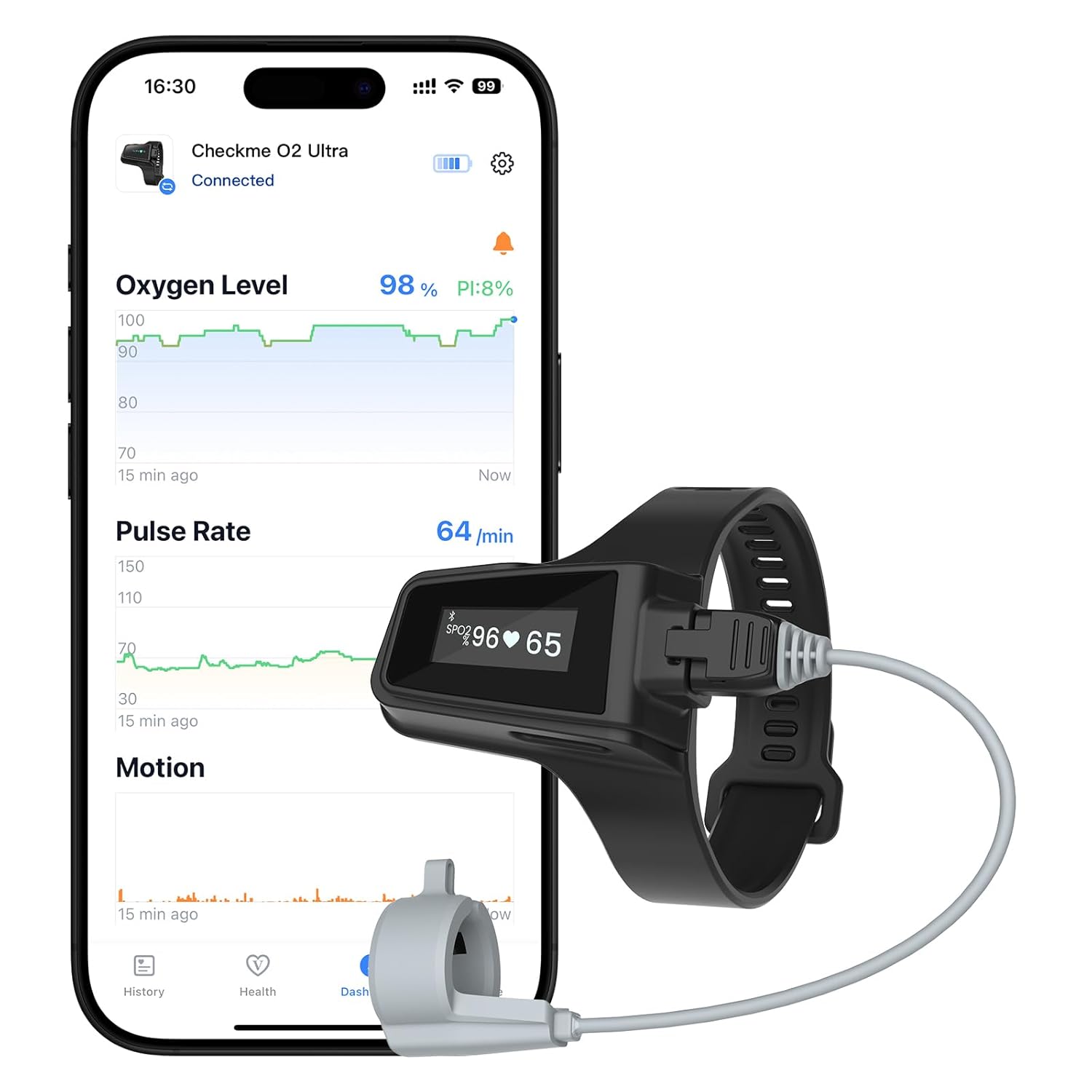 Wellue Checkme O2 Ultra Wrist Pulse Oximeter with Bluetooth SpO2 and Pulse Rate

