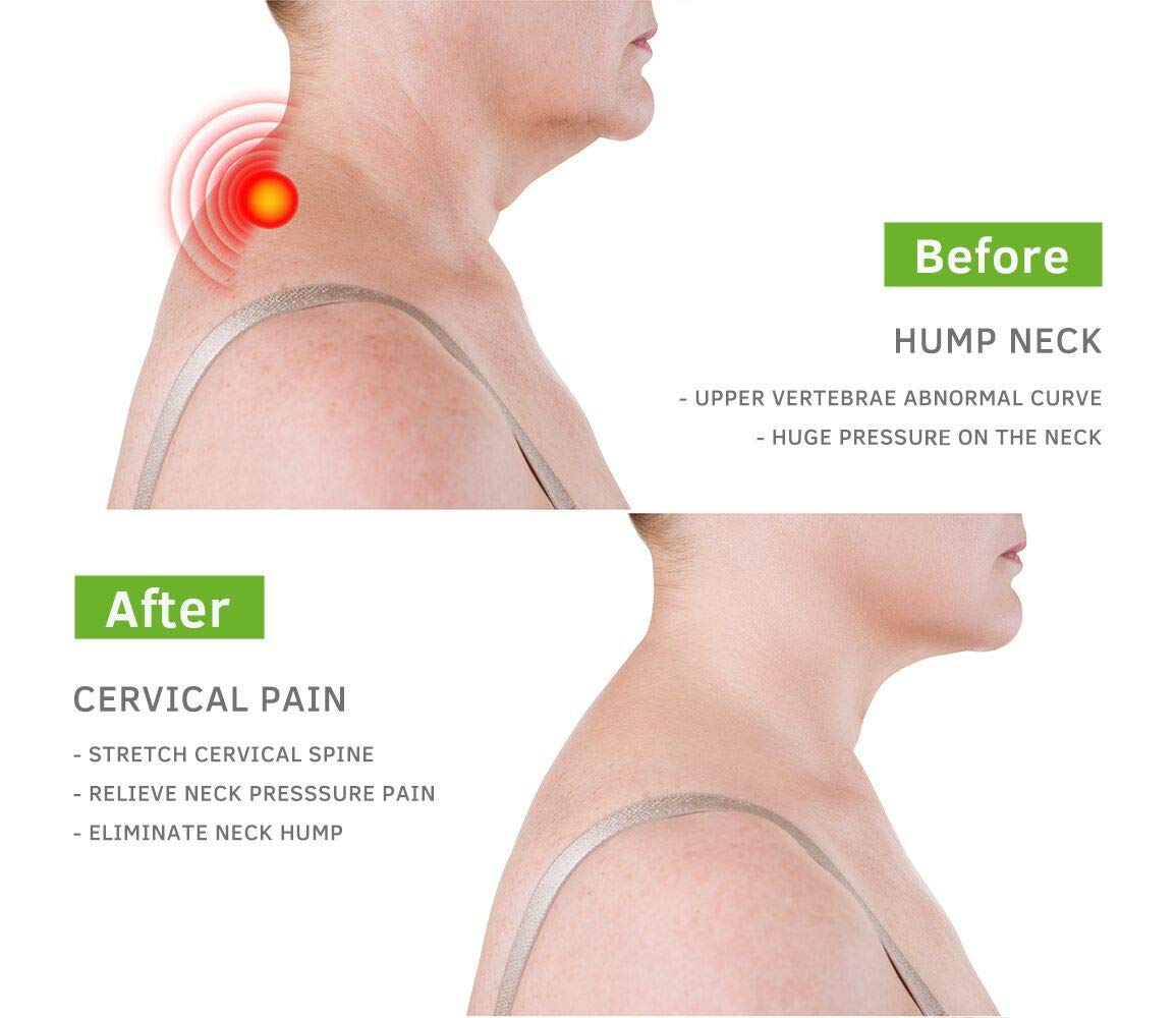 Beibye Upper Back and Headache Pain Relief Back Stretcher Posture Corrector

