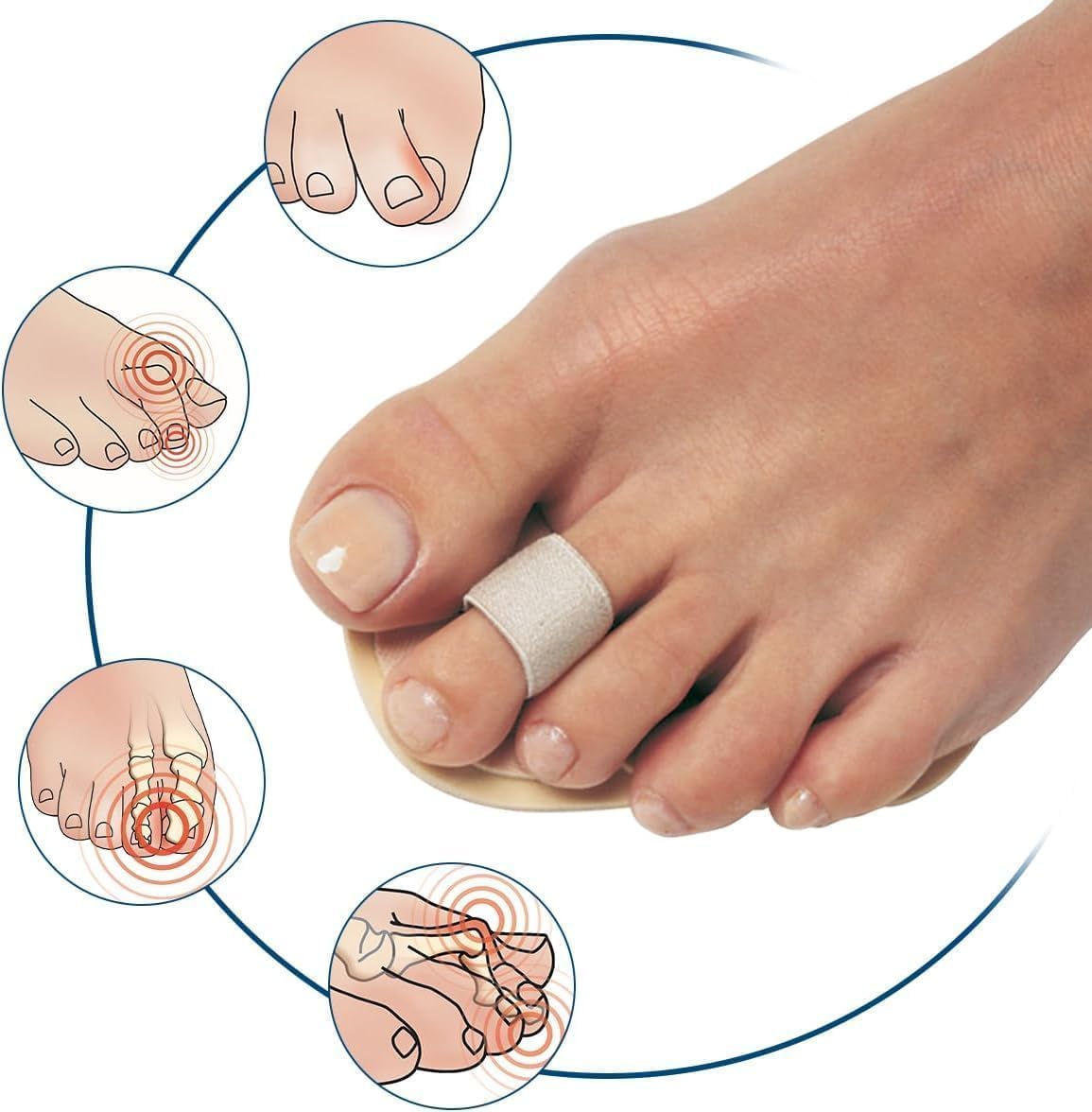 PediFix Toe Straightener with Cushioned Foam Pad for Crooked, Overlapping Toes


