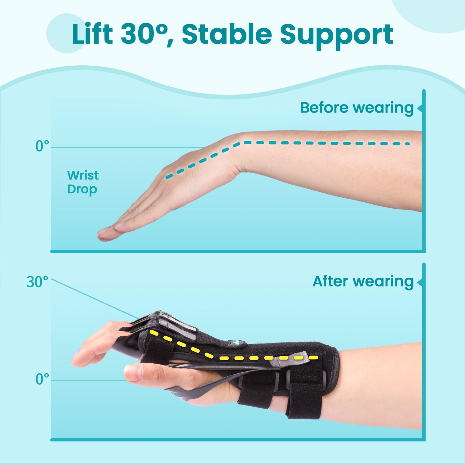 DrFinger Radial Nerve Palsy Wrist Drop Hand Splint Brace with Five-Finger Support

