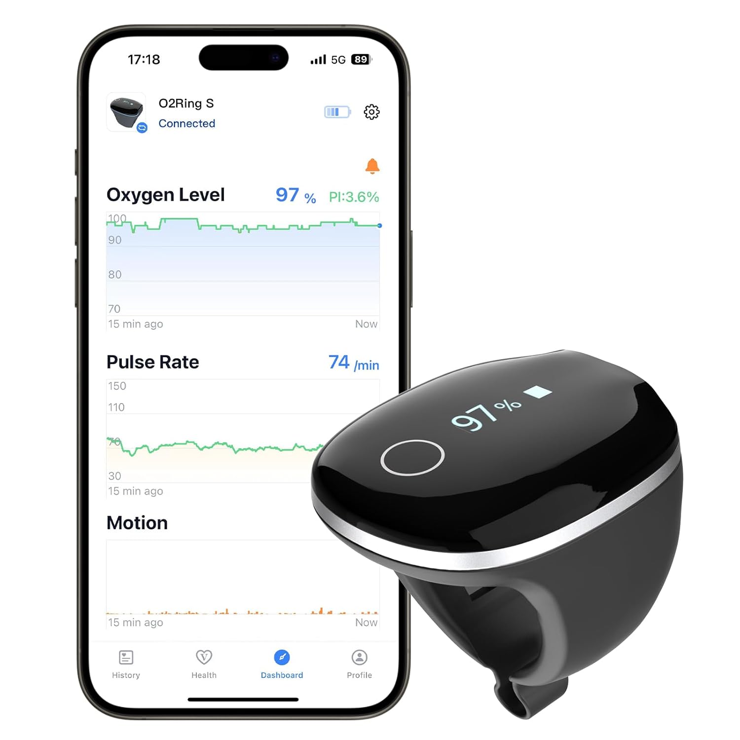 Wellue O2Ring-S Ring Pulse Oximeter Oxygen Monitor with SpO2 and Vibration Reminder

