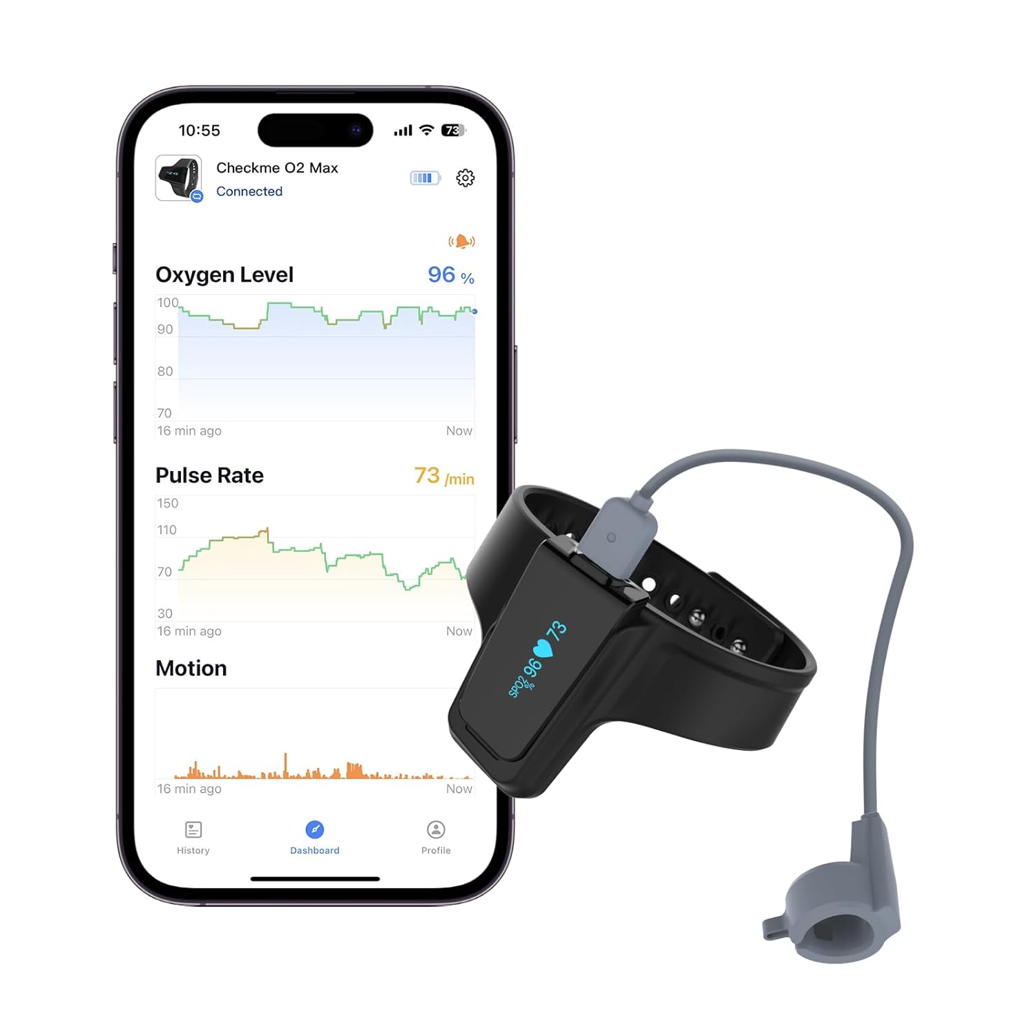 Wearpulse Wrist Pulse Oximeter, Wearable Oxygen Monitor with Bluetooth, 72-Hour Battery

