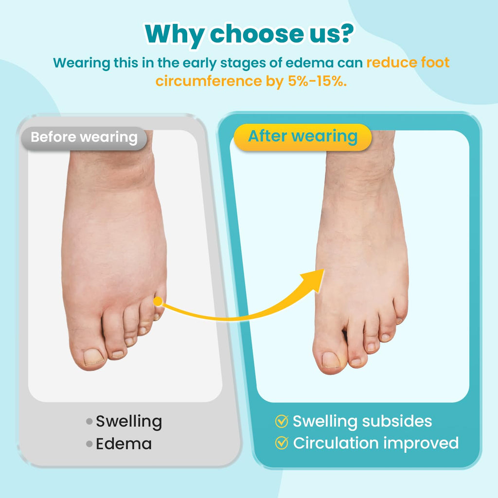 Sylong Swollen Foot & Ankle Compression Wrap Adjustable Brace Edema Sleeve

