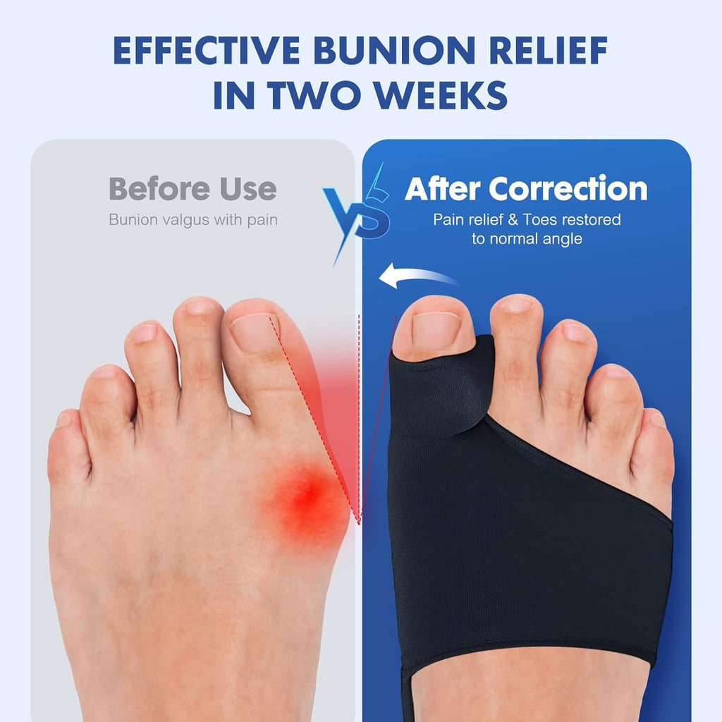 QCCL Bunion Corrector for Big Toe, Hallux Valgus Gel Cushion with Anti-Slip Pads

