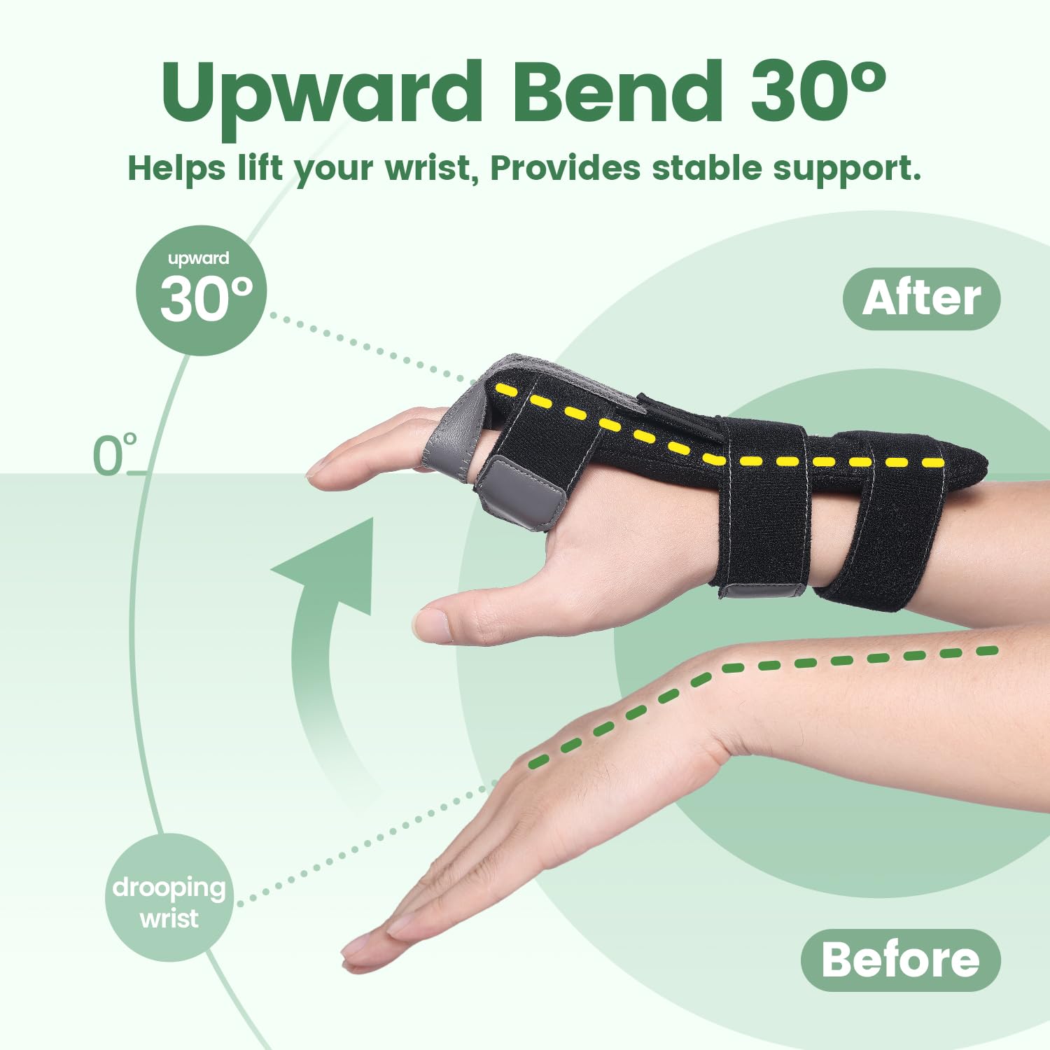 DrFinger Radial Nerve Palsy Hand Splint Brace for Finger Extension and Wrist Support

