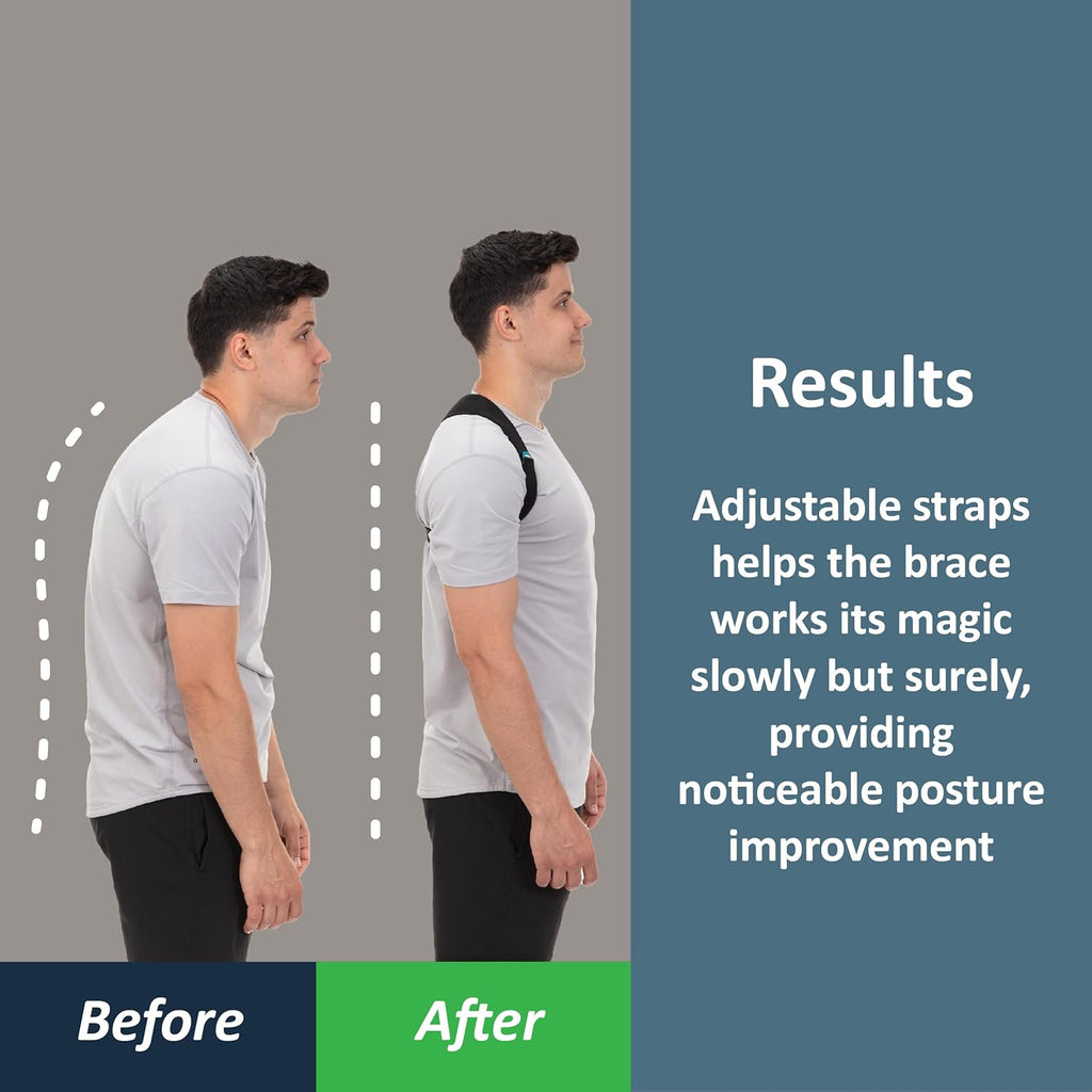 ComfyBrace Posture Corrector Back Brace for Men and Women, Adjustable Straightener

