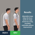 ComfyBrace Posture Corrector Back Brace for Men and Women, Adjustable Straightener

