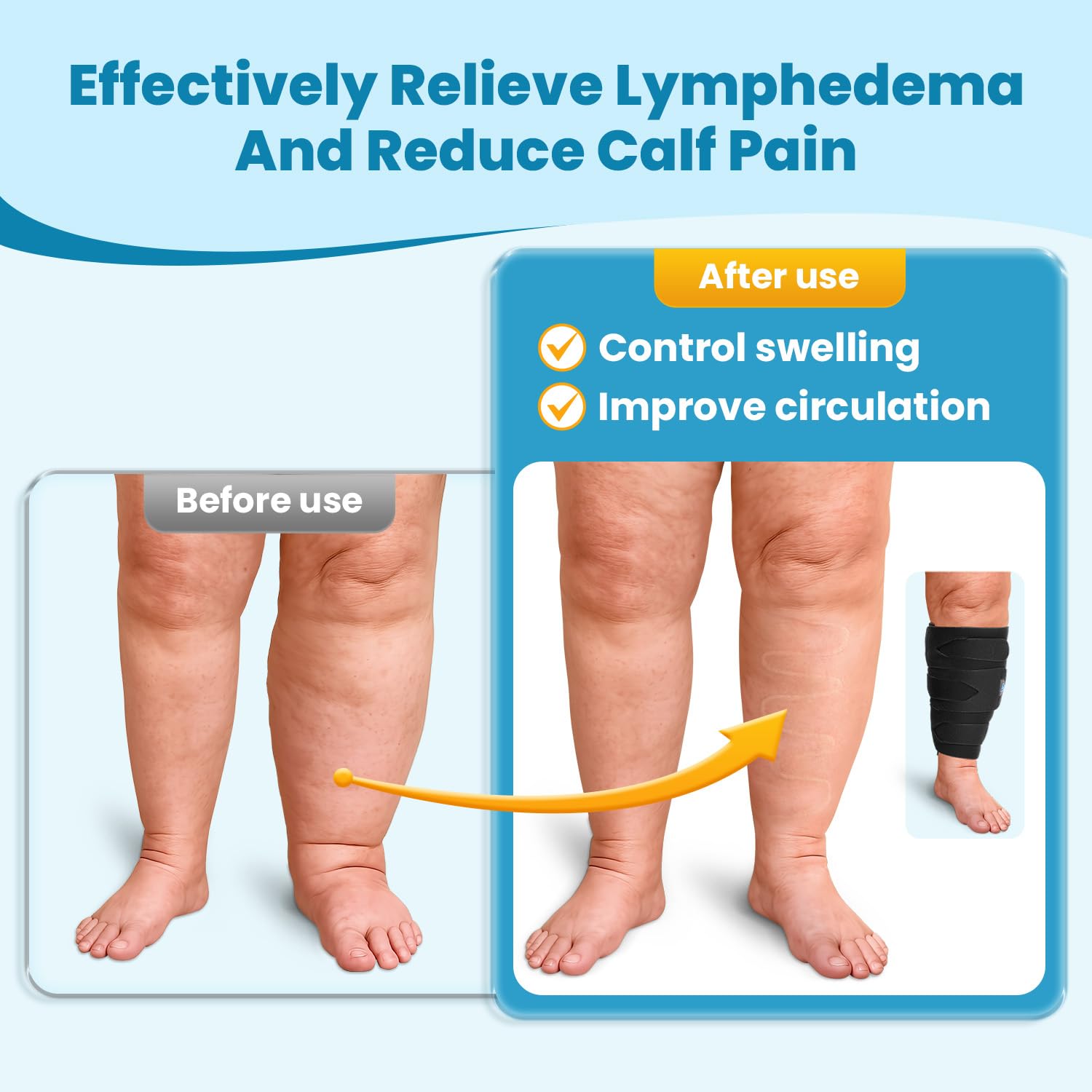 iDonua Lymphedema Compression Wrap for Lower Leg, Adjustable Cross Straps


