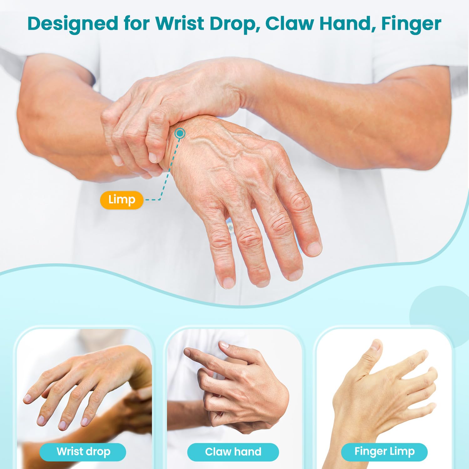 DrFinger Radial Nerve Palsy Wrist Drop Hand Splint Brace with Five-Finger Support

