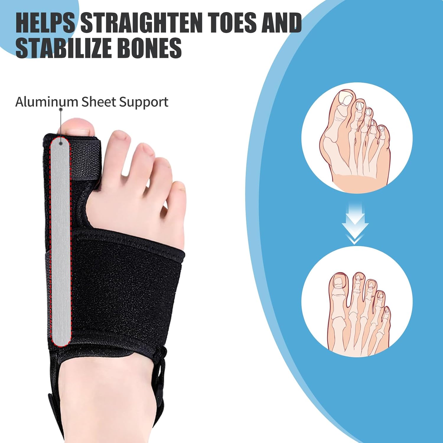 Recovist Bunion Brace for Big Toe Straightener with Aluminum Splints

