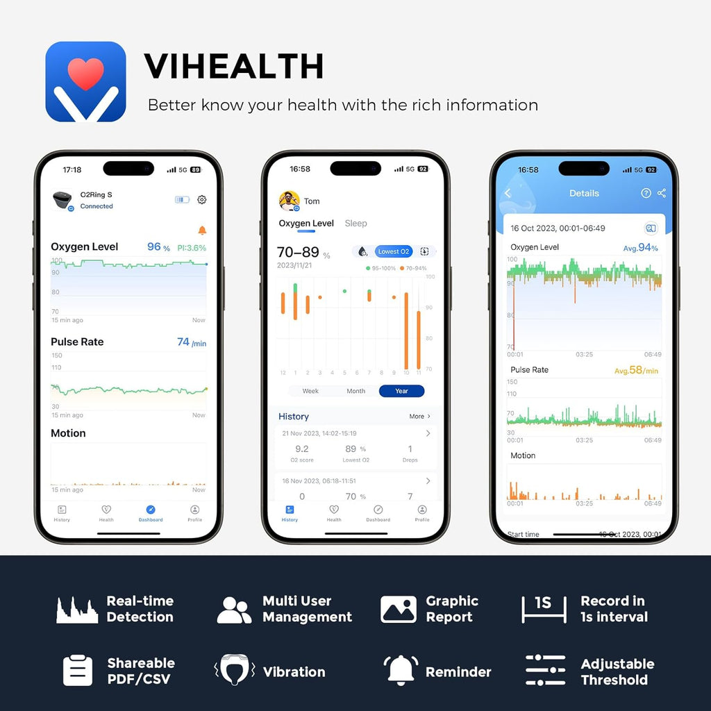 Wellue O2Ring-S Ring Pulse Oximeter Oxygen Monitor with SpO2 and Vibration Reminder


