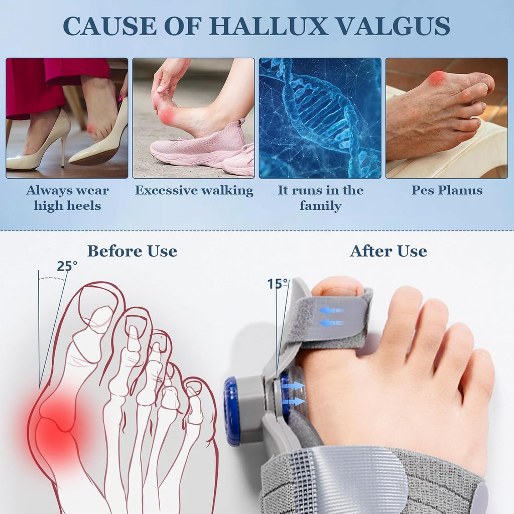 Adjustable Bunion Corrector Toe Straightener for Hallux Valgus Relief Splint

