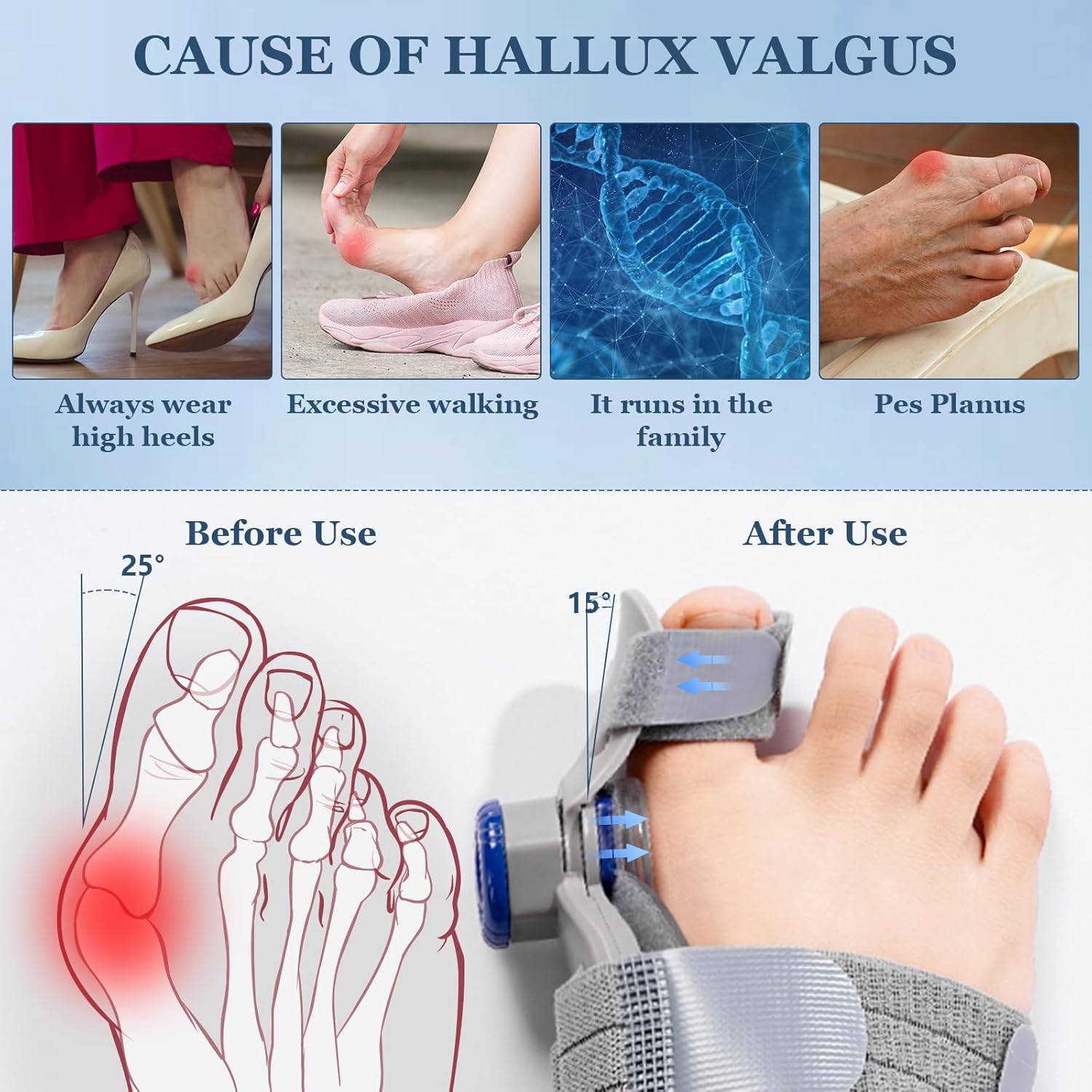 Adjustable Bunion Corrector Toe Straightener for Hallux Valgus Relief Splint

