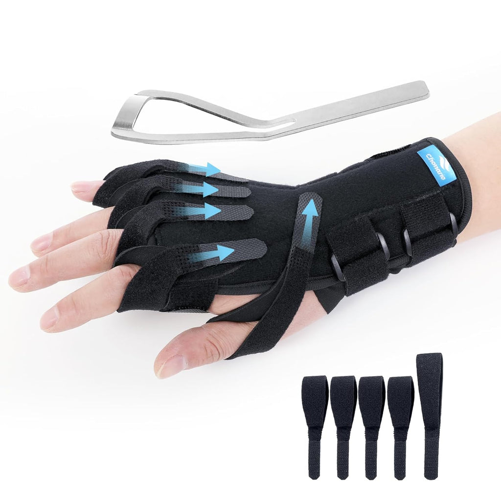 Chonario Radial Nerve Palsy Splint for Wrist Drop, Finger Extension Brace

