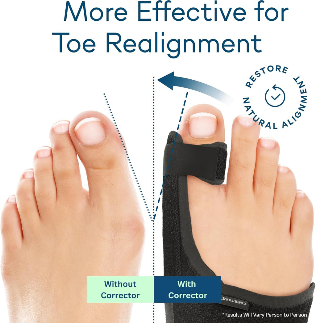 Caretras Bunion Corrector 2-Pack, Orthopedic Hallux Valgus Splint for Comfort

