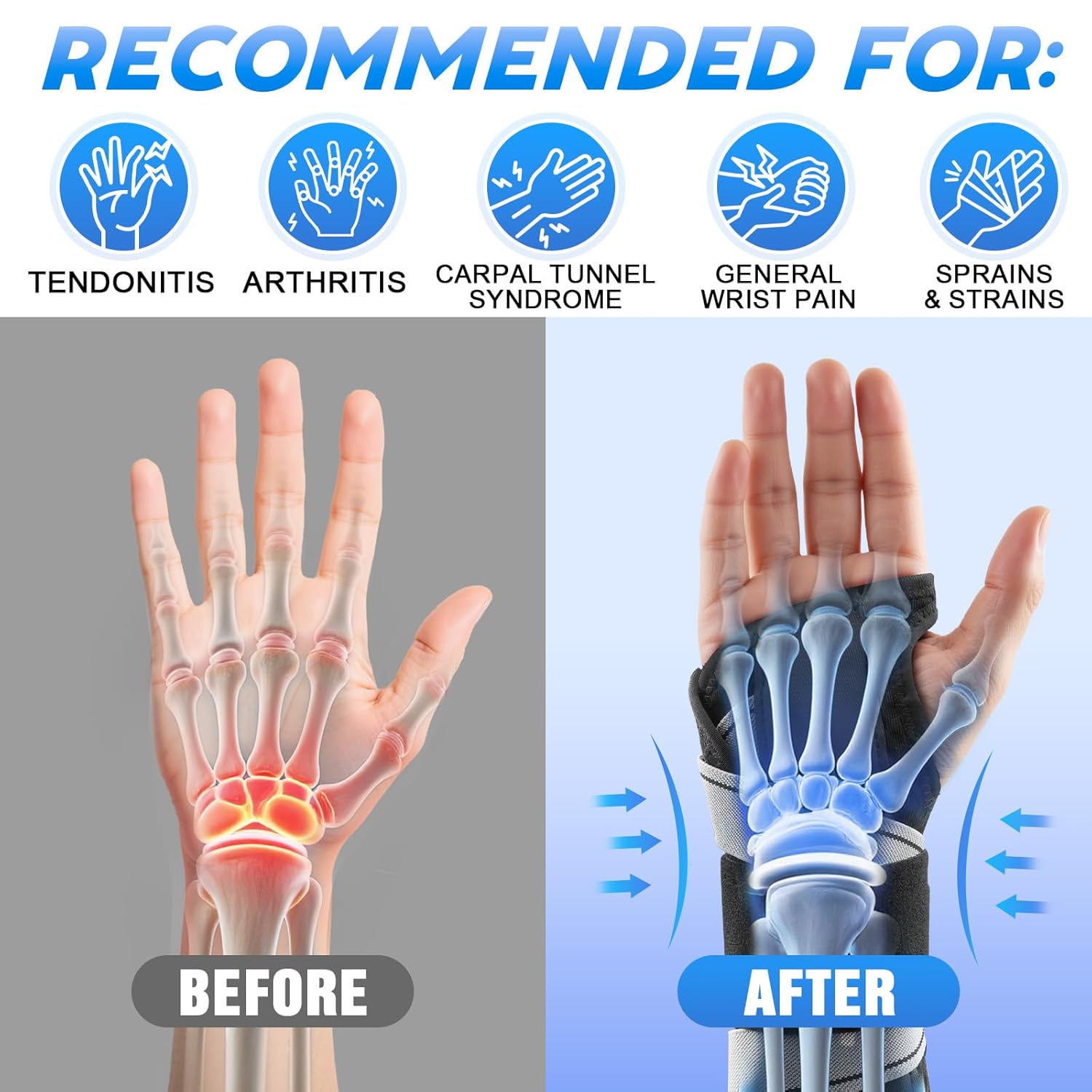 NEVVIS Carpal Tunnel Night Wrist Brace with Metal Splint, Adjustable Support

