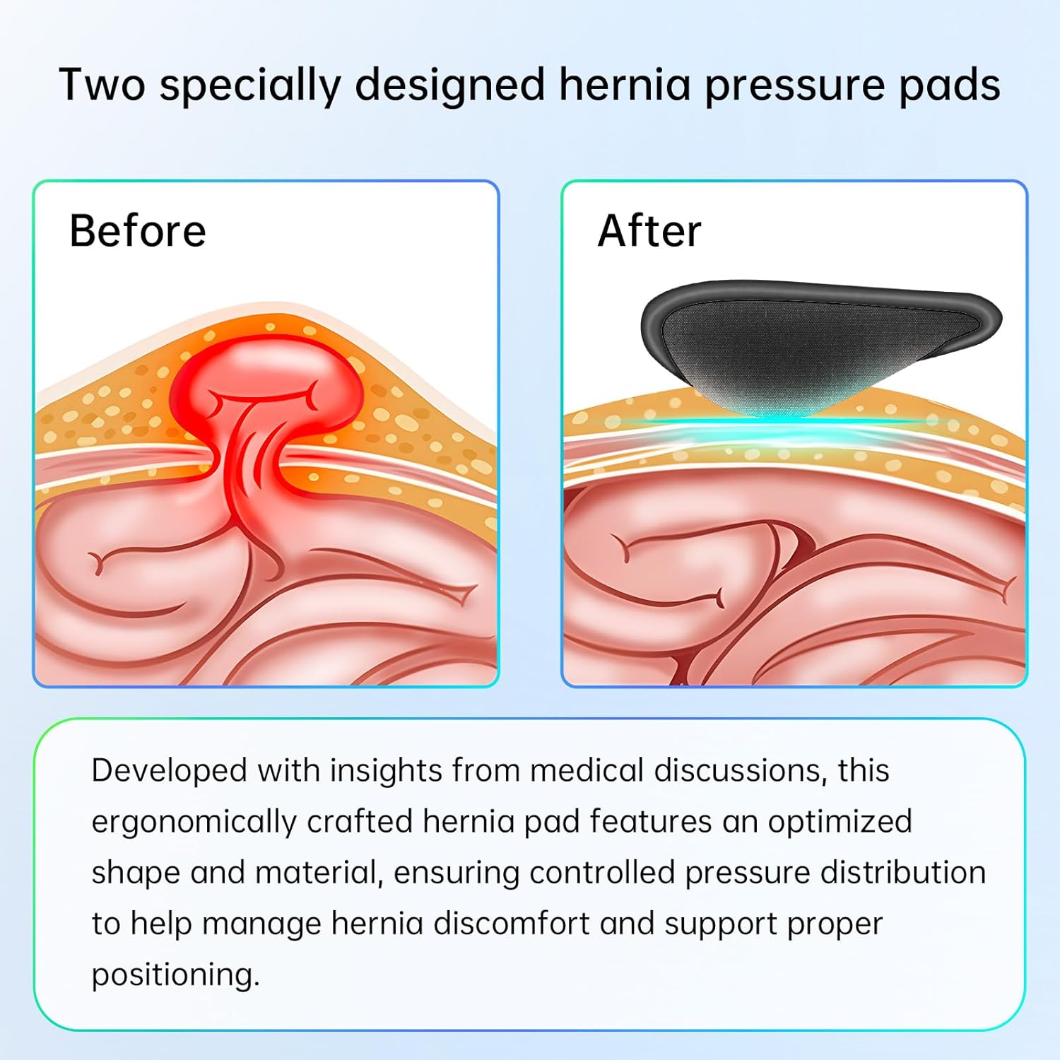 ZEAZEN Hernia Belt for Men Adjustable Inguinal Hernia Support Brace

