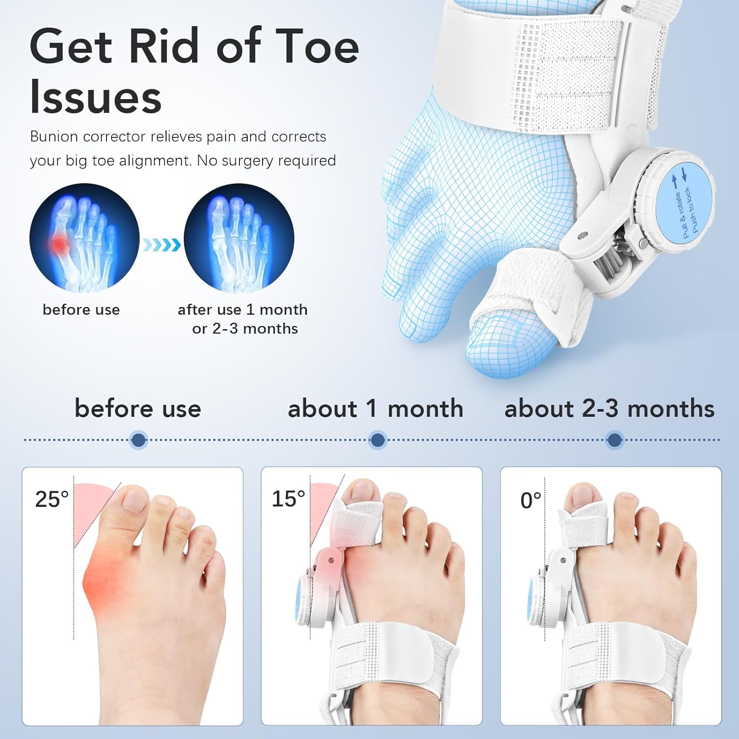 Adjustable Bunion Corrector Splint for Hallux Valgus Toe Straightener Brace

