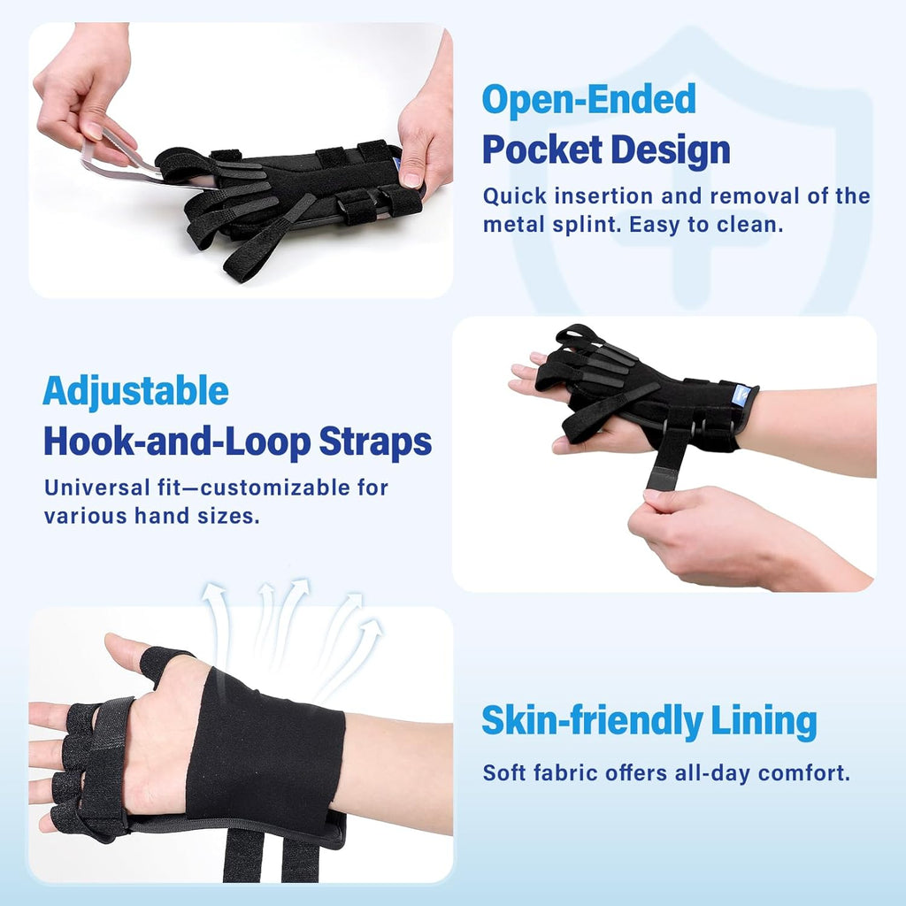 Chonario Radial Nerve Palsy Splint for Wrist Drop, Finger Extension Brace

