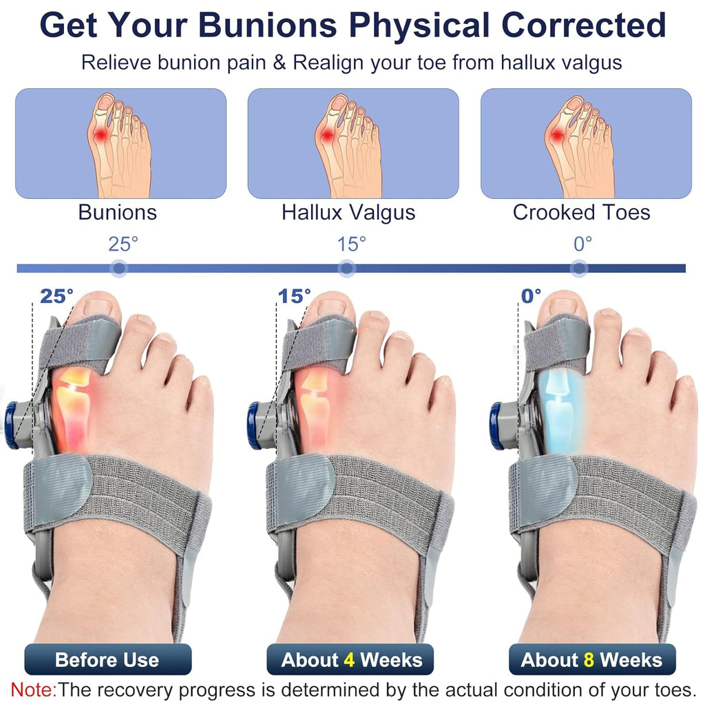 Treatmedy Adjustable Bunion Corrector for Big Toe, Orthopedic Toe Straightener Splint

