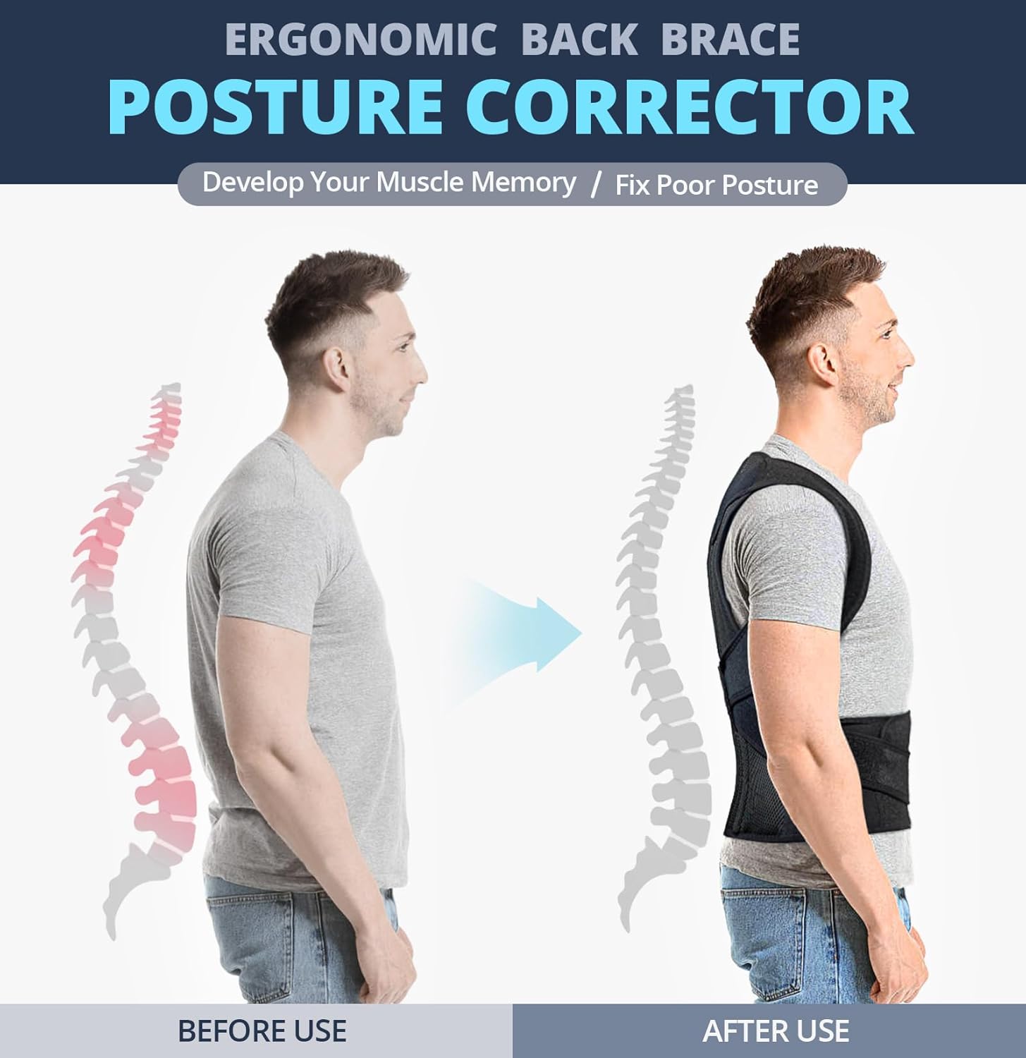Fitsupport Posture Corrector Back Brace for Men and Women, Lumbar Support

