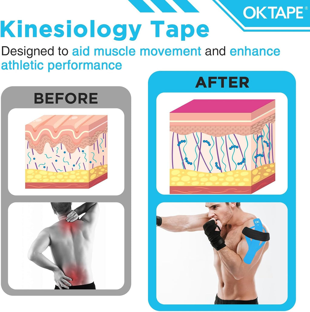 OK TAPE Precut Kinesiology Tape Strips, Elastic Athletic Tape for Joint Support


