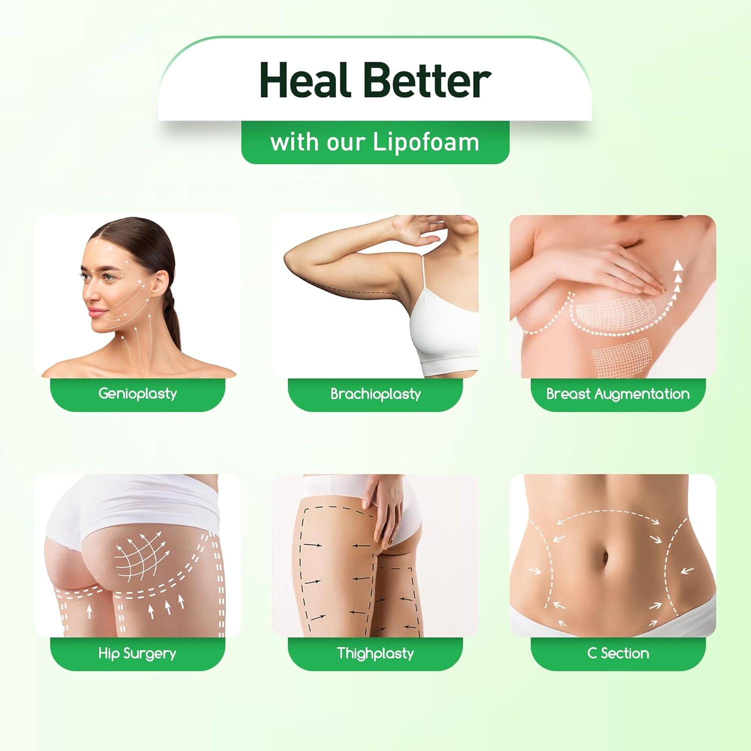 AcuPlush Lipo Foam Pads for Liposuction Recovery, Abdominal Support Board 8x11

