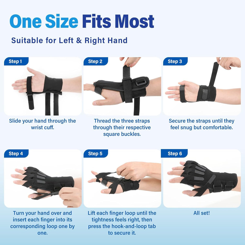 Chonario Radial Nerve Palsy Splint for Wrist Drop, Finger Extension Brace

