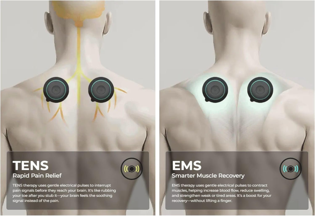 Chirp Halo Wireless EMS Muscle Stimulator, Portable Electrical Muscle Recovery Device

