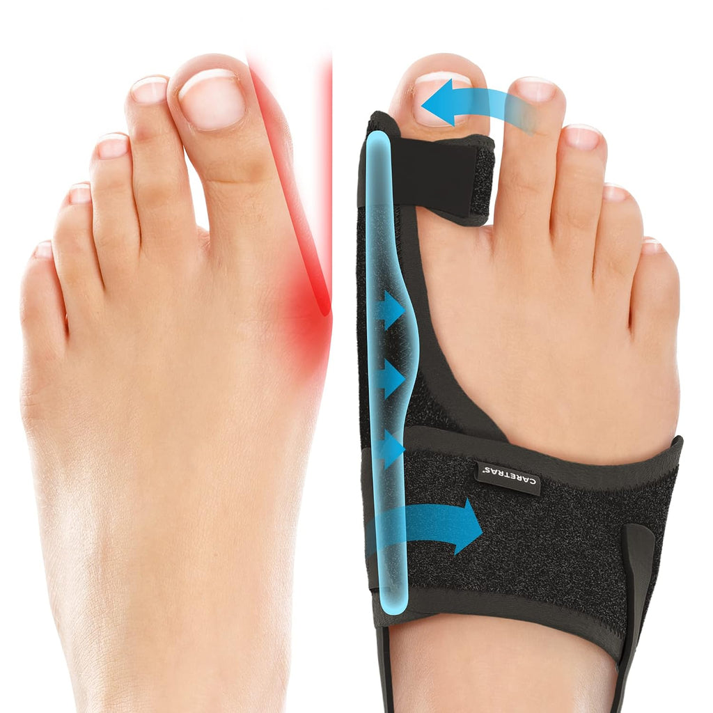 Caretras Bunion Corrector 2-Pack, Orthopedic Hallux Valgus Splint for Comfort