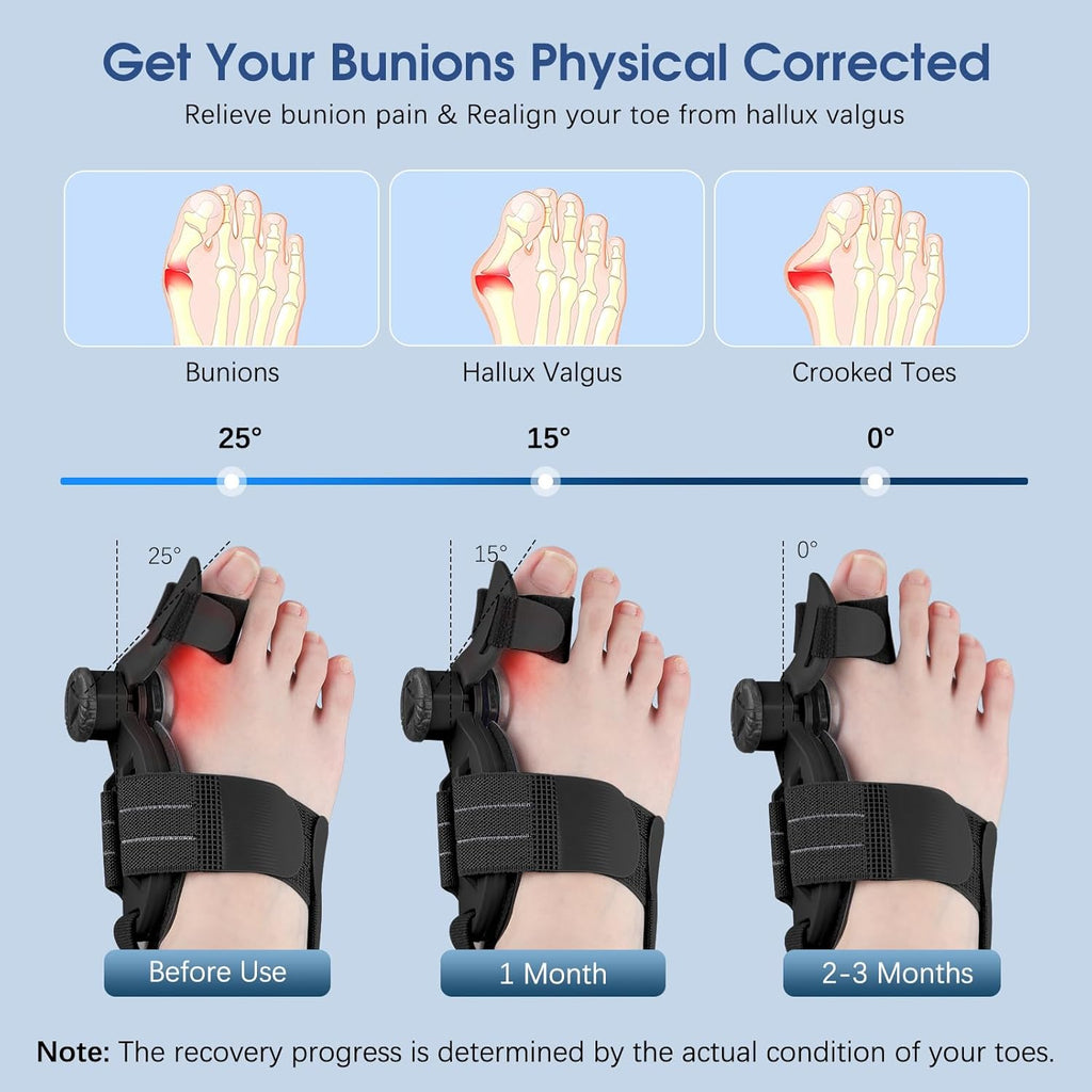 KASHEVI Adjustable Bunion Corrector for Big Toe, Hallux Valgus Splint

