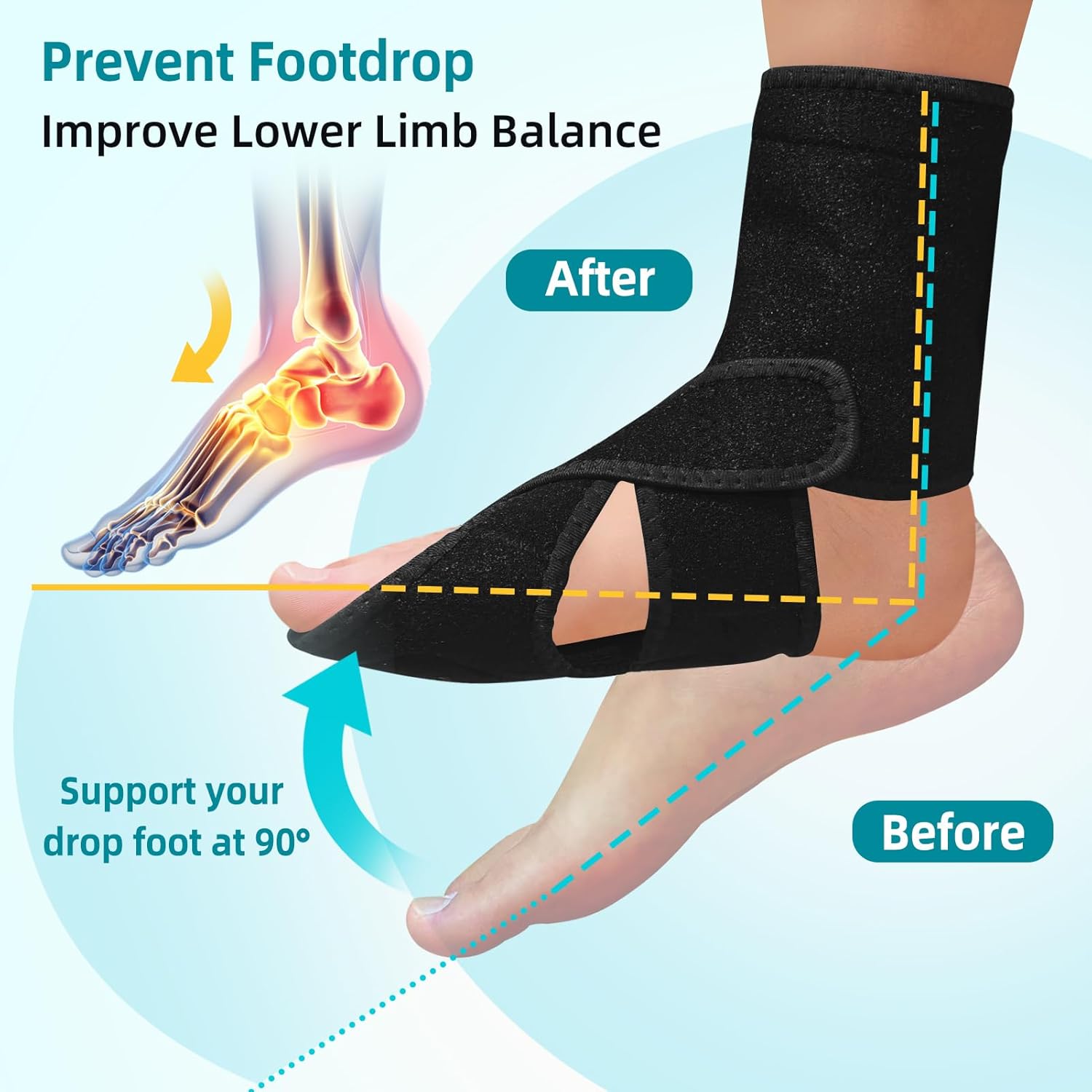 DR.GINTOP AFO Foot Drop Brace with Arch Support for Walking and Night Splint

