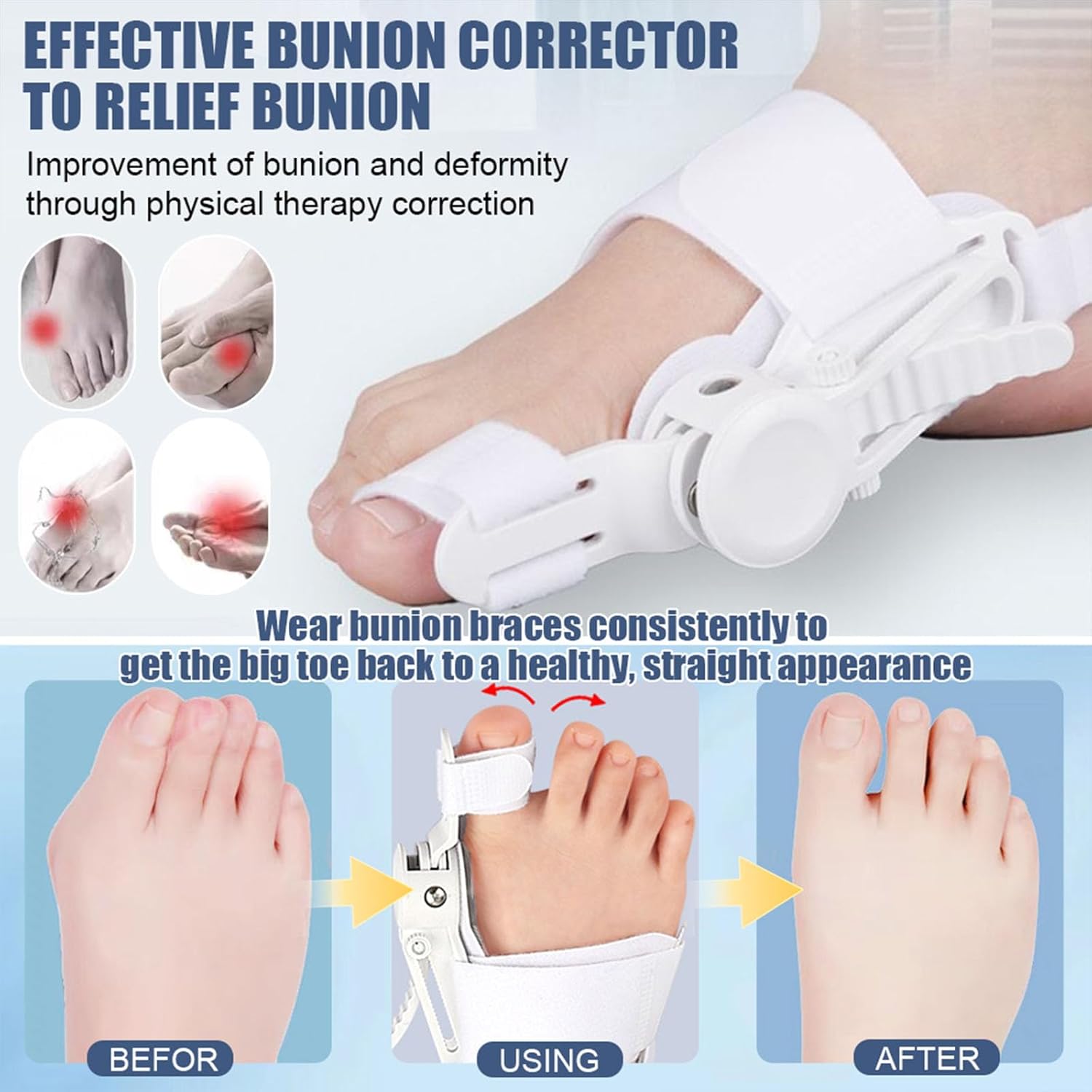 Adjustable Nighttime Bunion Corrector for Hallux Valgus Big Toe Straightener Brace

