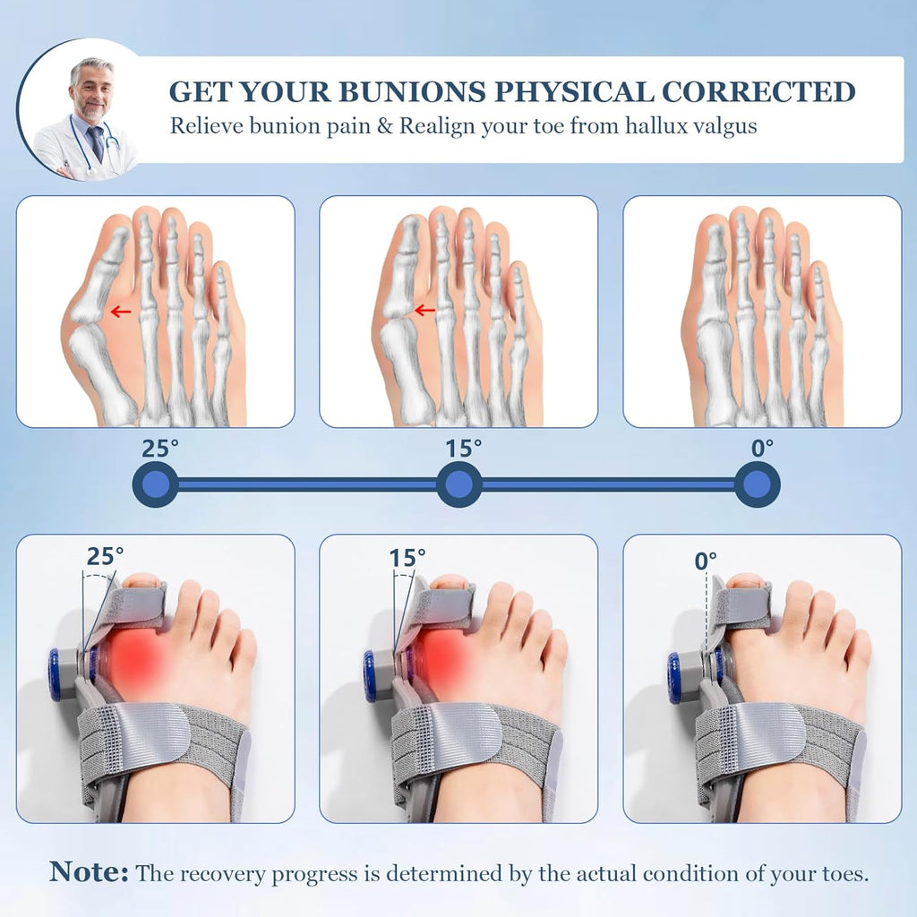 Adjustable Bunion Corrector Toe Straightener for Hallux Valgus Relief Splint

