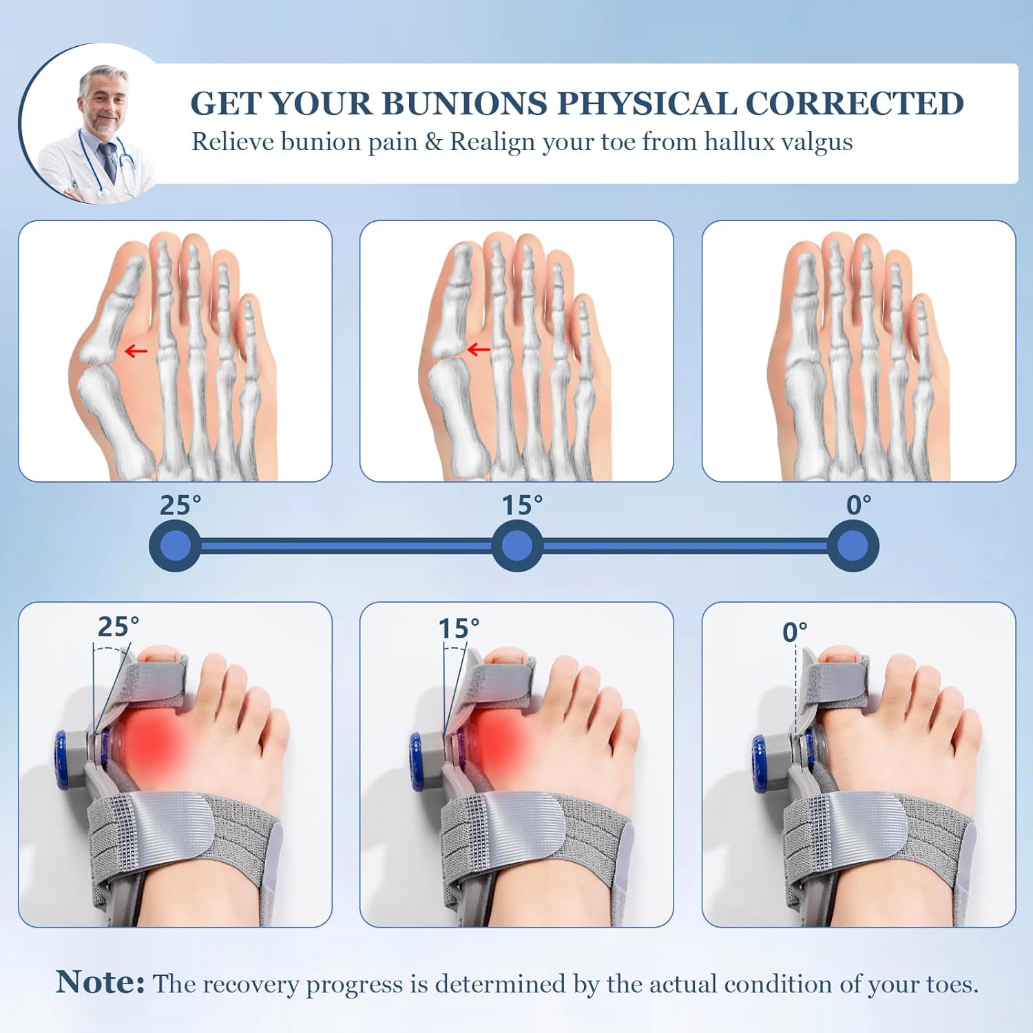Adjustable Bunion Corrector Toe Straightener for Hallux Valgus Relief Splint

