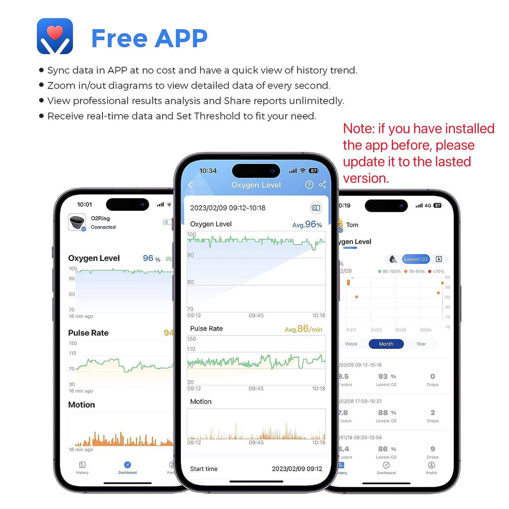 Wellue O2Ring Pulse Oximeter Bluetooth SpO2 Blood Oxygen Monitor Ring Sensor

