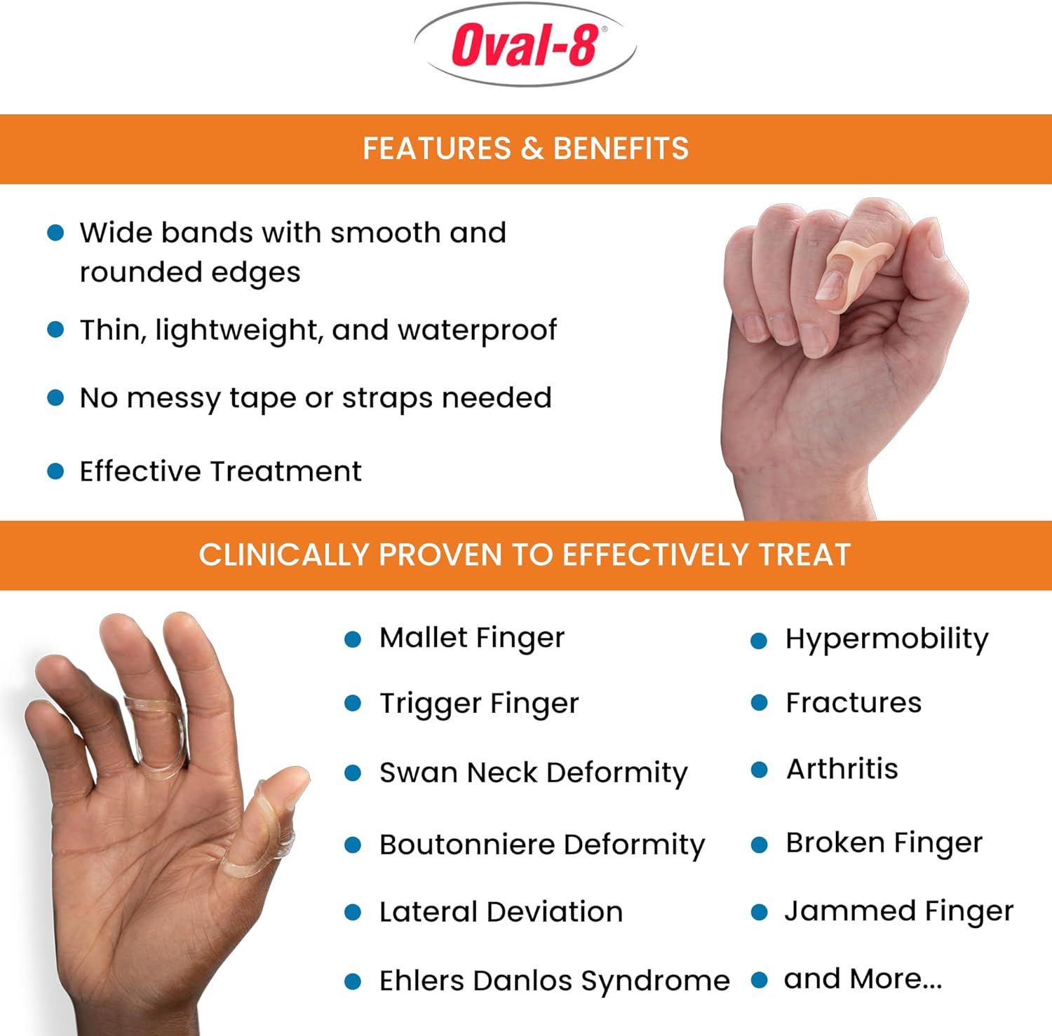 Oval-8 Finger Splint Multi-Size Assortment

