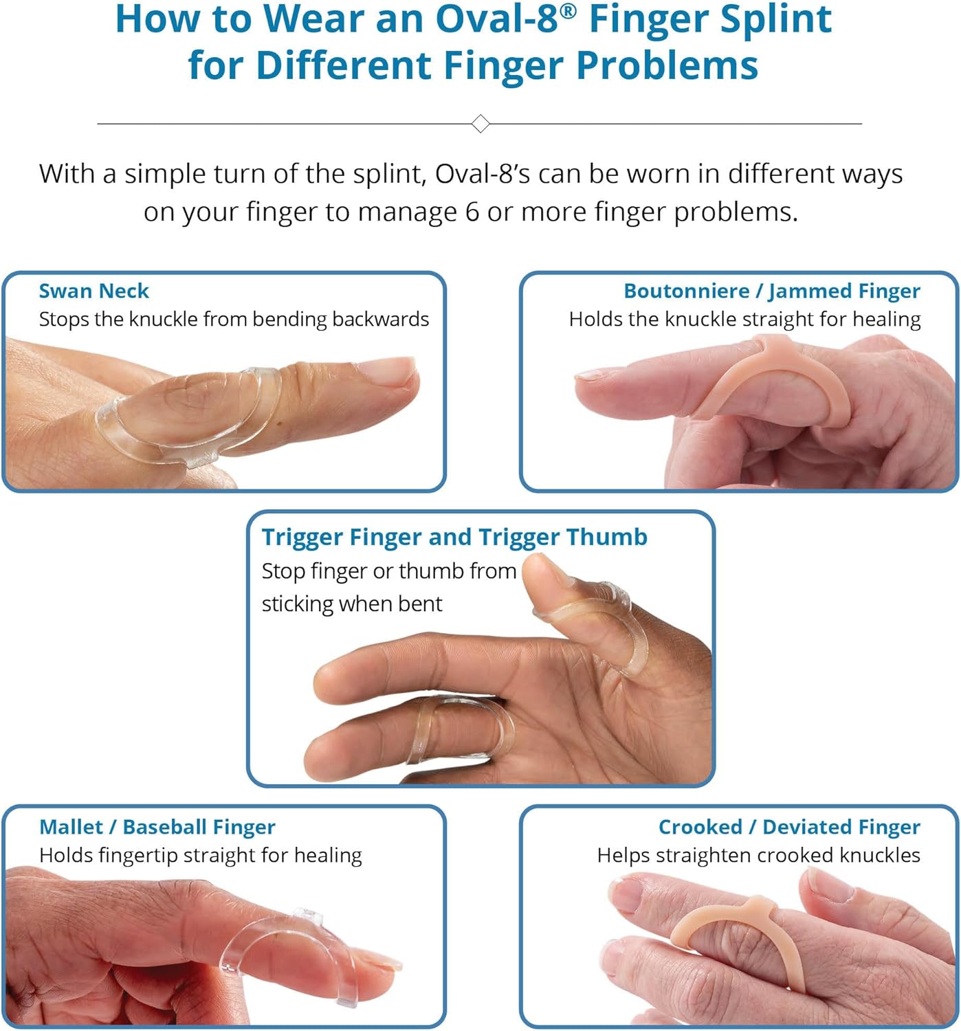 Oval-8 Finger Splint Multi-Size Assortment

