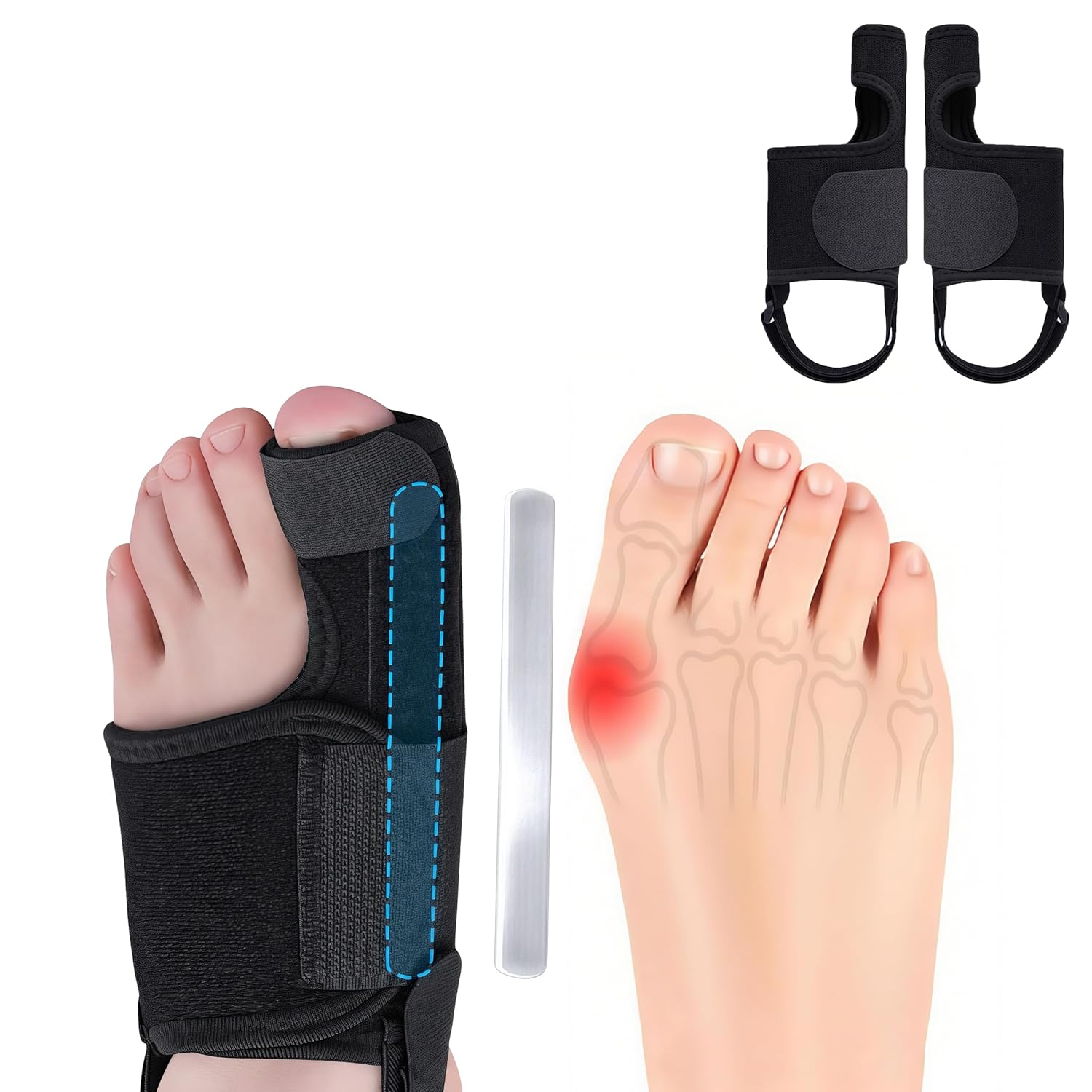 Recovist Bunion Brace for Big Toe Straightener with Aluminum Splints

