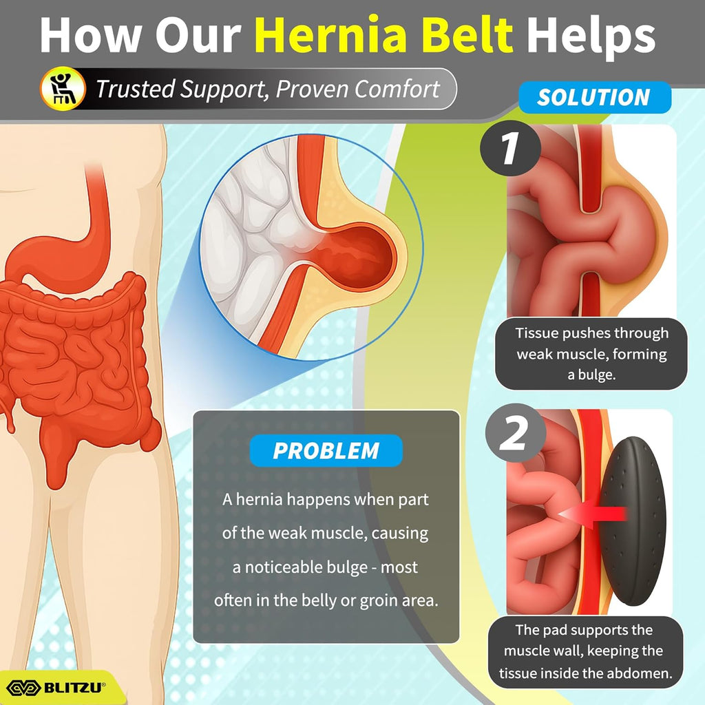 BLITZU Umbilical Hernia Belt for Men & Women, Adjustable Abdominal Binder Truss Support

