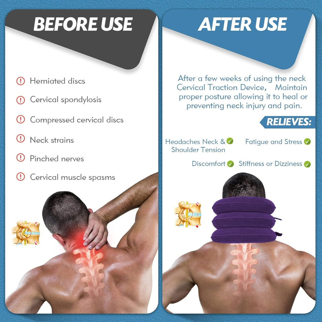 Jaximy Inflatable Cervical Traction Neck Brace for Neck Pain Relief Home Use

