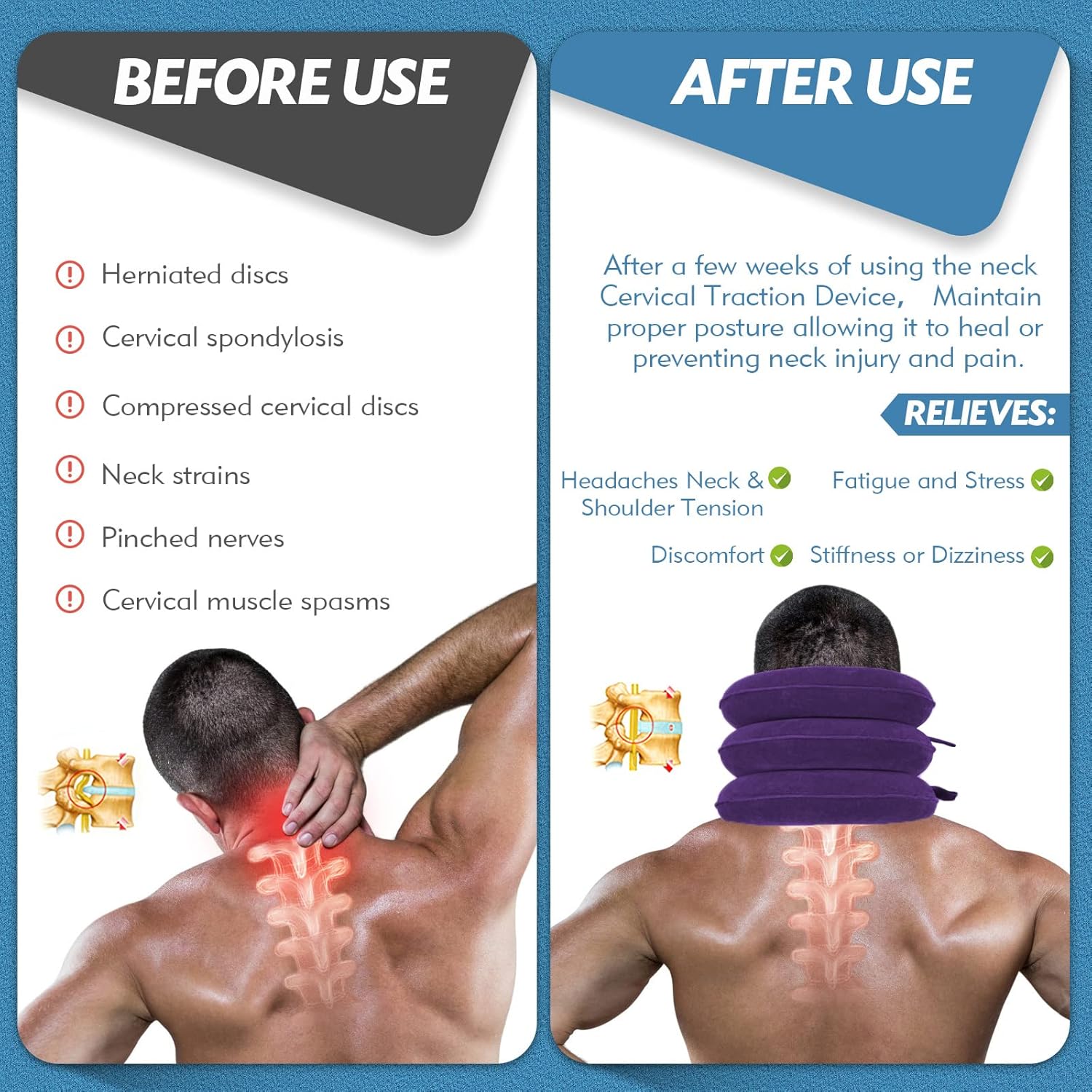 Jaximy Inflatable Cervical Traction Neck Brace for Neck Pain Relief Home Use

