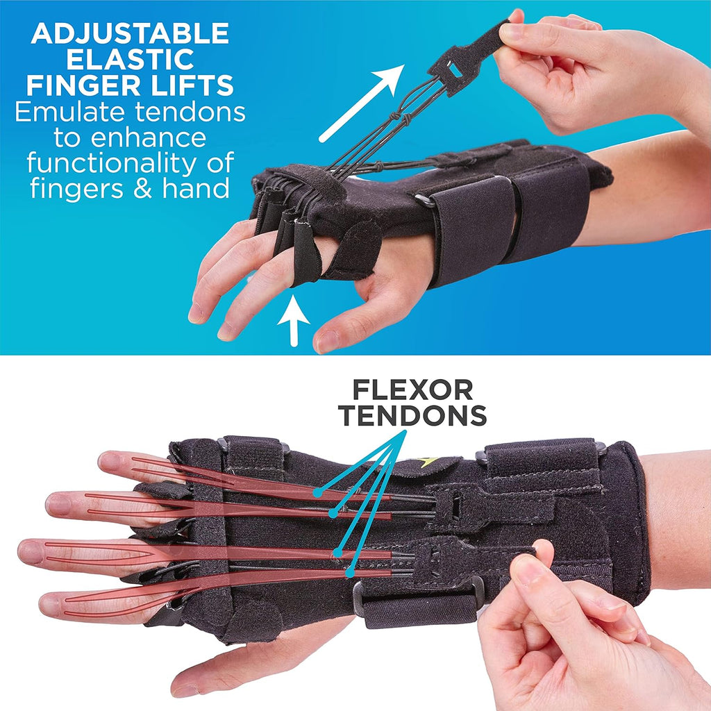 BraceAbility Radial Nerve Palsy Dynamic Wrist Extension Splint for Right or Left


